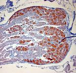 P2RX7 Antibody in Immunohistochemistry (Paraffin) (IHC (P))