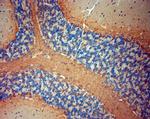 P2RX7 Antibody in Immunohistochemistry (Paraffin) (IHC (P))