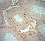 PIST Antibody in Immunohistochemistry (Paraffin) (IHC (P))