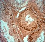 PIST Antibody in Immunohistochemistry (Paraffin) (IHC (P))