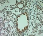 P2RY1 Antibody in Immunohistochemistry (Paraffin) (IHC (P))