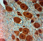 PGP 9.5 Antibody in Immunohistochemistry (Paraffin) (IHC (P))