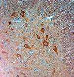 PGP 9.5 Antibody in Immunohistochemistry (Paraffin) (IHC (P))