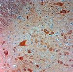 PGP 9.5 Antibody in Immunohistochemistry (Paraffin) (IHC (P))