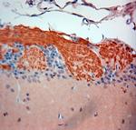 OMP Antibody in Immunohistochemistry (Paraffin) (IHC (P))