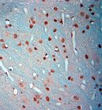 c-Fos Antibody in Immunohistochemistry (Paraffin) (IHC (P))