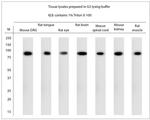 TRPV1 Antibody in Western Blot (WB)