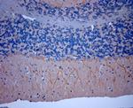 TRPV2 Antibody in Immunohistochemistry (Paraffin) (IHC (P))