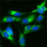 RAB7 Antibody in Immunocytochemistry (ICC/IF)