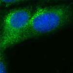 RAB7 Antibody in Immunocytochemistry (ICC/IF)