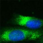 RAB7 Antibody in Immunocytochemistry (ICC/IF)