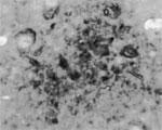 Runx3 Antibody in Immunohistochemistry (Paraffin) (IHC (P))