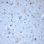 RAB4B Antibody in Immunohistochemistry (Paraffin) (IHC (P))