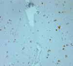 REEP6 Antibody in Immunohistochemistry (Paraffin) (IHC (P))