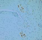 REEP6 Antibody in Immunohistochemistry (Paraffin) (IHC (P))