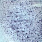 Sortilin Antibody in Immunohistochemistry (IHC)