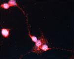 Sortilin Antibody in Immunocytochemistry (ICC/IF)