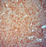 Synaptophysin Antibody in Immunohistochemistry (Paraffin) (IHC (P))