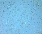 Synaptotagmin 1 Antibody in Immunohistochemistry (Paraffin) (IHC (P))