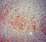 Synaptotagmin 2 Antibody in Immunohistochemistry (Paraffin) (IHC (P))