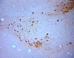 SNIP Antibody in Immunohistochemistry (Paraffin) (IHC (P))