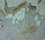 Nav1.8 Antibody in Immunohistochemistry (Paraffin) (IHC (P))