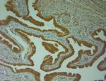 Nav1.8 Antibody in Immunohistochemistry (Paraffin) (IHC (P))