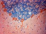 STIM1 Antibody in Immunohistochemistry (Paraffin) (IHC (P))