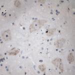 5HT5A R Antibody in Immunohistochemistry (Paraffin) (IHC (P))