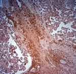 SRD5A2 Antibody in Immunohistochemistry (Paraffin) (IHC (P))