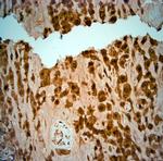 SRD5A2 Antibody in Immunohistochemistry (Paraffin) (IHC (P))