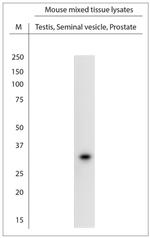 SRD5A2 Antibody in Western Blot (WB)