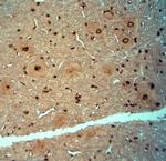 Striatin 4 Antibody in Immunohistochemistry (Paraffin) (IHC (P))