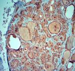 SLC5A8 Antibody in Immunohistochemistry (Paraffin) (IHC (P))