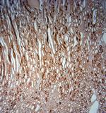 SLC5A8 Antibody in Immunohistochemistry (Paraffin) (IHC (P))