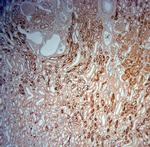 SLC5A8 Antibody in Immunohistochemistry (Paraffin) (IHC (P))