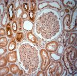 SLC5A8 Antibody in Immunohistochemistry (Paraffin) (IHC (P))