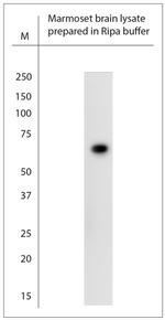 SLC5A8 Antibody in Western Blot (WB)