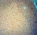 Synaptojanin1 Antibody in Immunohistochemistry (Paraffin) (IHC (P))