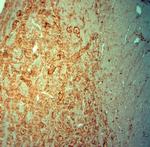 Synaptophysin Antibody in Immunohistochemistry (Paraffin) (IHC (P))