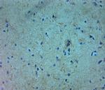 TRPM7 Antibody in Immunohistochemistry (Paraffin) (IHC (P))