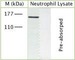 TRPM7 Antibody in Western Blot (WB)