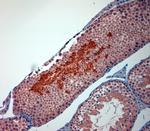 TRPM8 Antibody in Immunohistochemistry (Paraffin) (IHC (P))