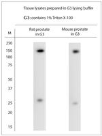 TRPM8 Antibody in Western Blot (WB)