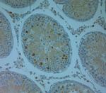 TRPV4 Antibody in Immunohistochemistry (Paraffin) (IHC (P))