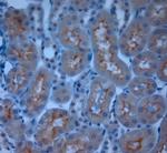 TRPM6 Antibody in Immunohistochemistry (Paraffin) (IHC (P))