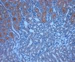 TRPM6 Antibody in Immunohistochemistry (Paraffin) (IHC (P))