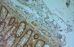 TPC1 Antibody in Immunohistochemistry (Paraffin) (IHC (P))