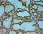 TPC1 Antibody in Immunohistochemistry (Paraffin) (IHC (P))