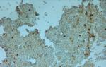 TPC1 Antibody in Immunohistochemistry (Paraffin) (IHC (P))